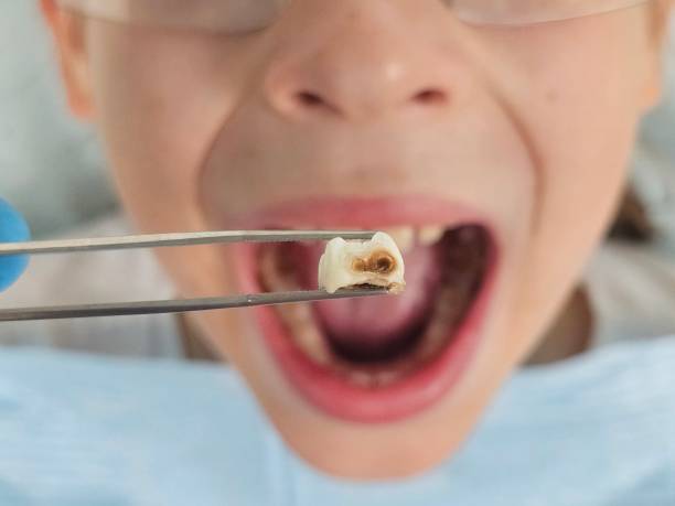 Best Cracked Tooth Emergency Dentist  in Ingram, PA